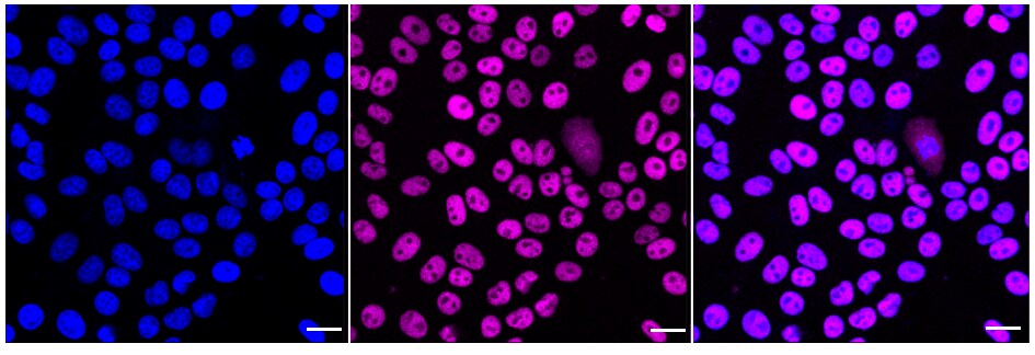 MBD2 Antibody (24GB460)