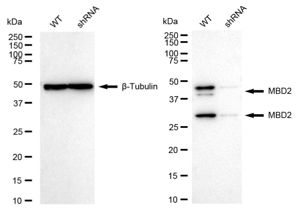 MBD2 Antibody (24GB460)