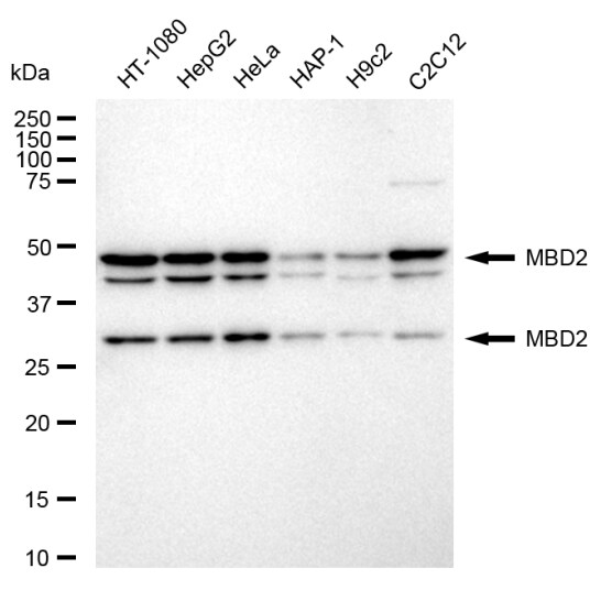 MBD2 Antibody (24GB460)