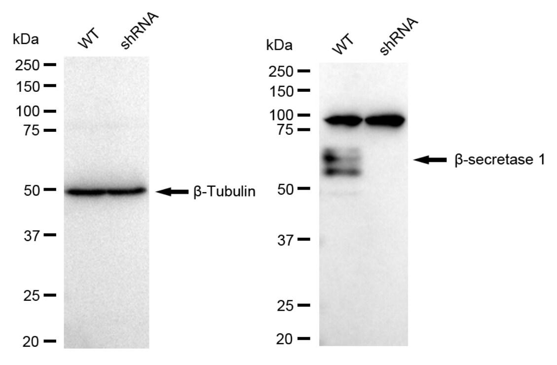BACE-1 Antibody (23GB4865)