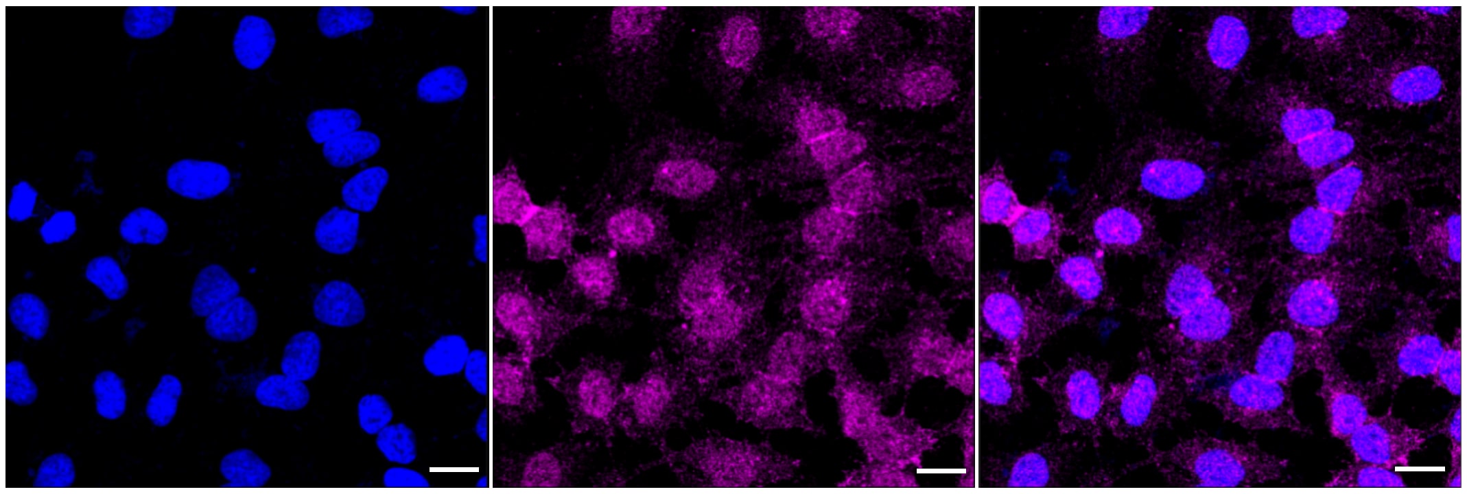 B7-H3/CD276 Antibody (23GB5035)