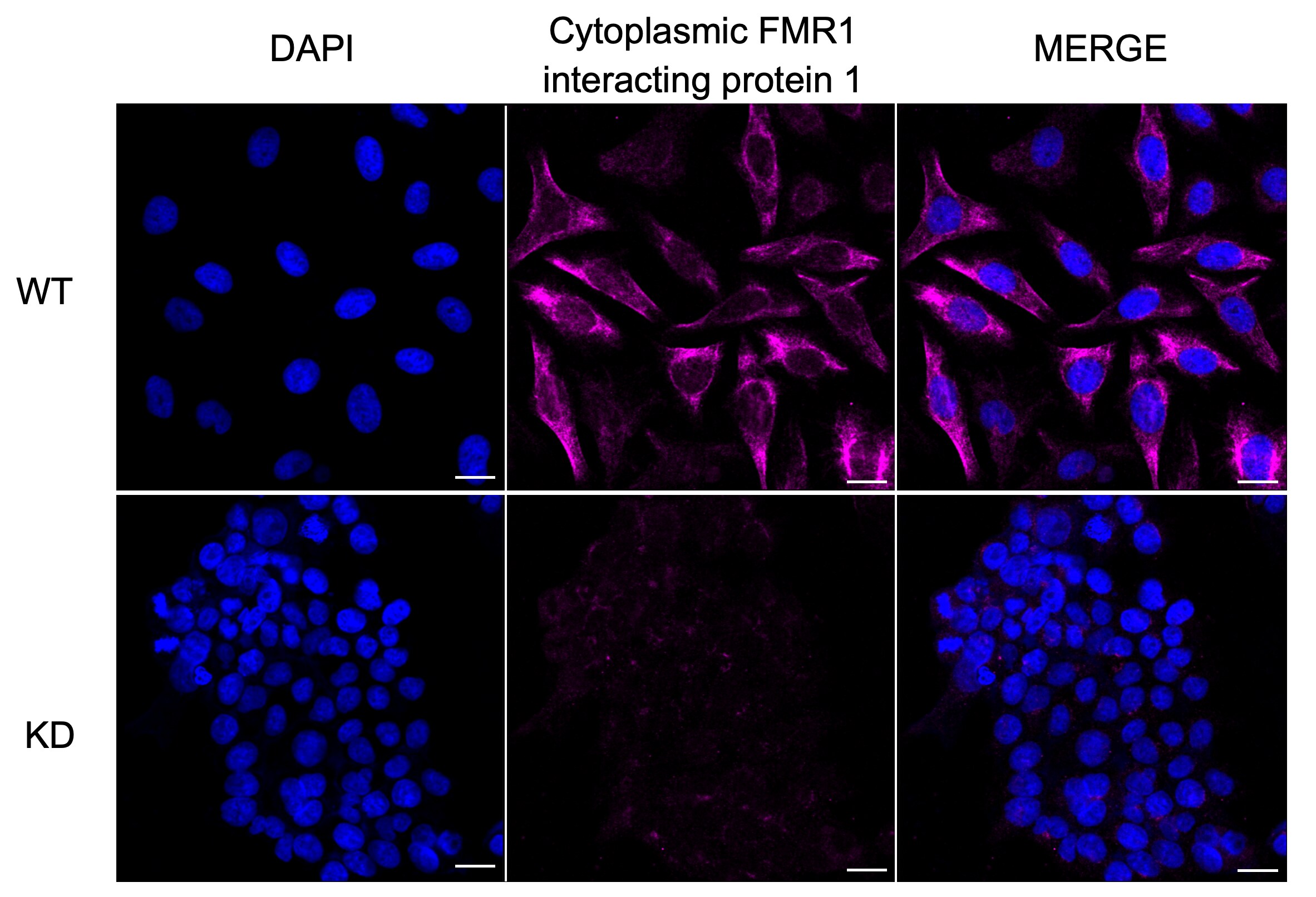 CYFIP1 Antibody (23GB1605)