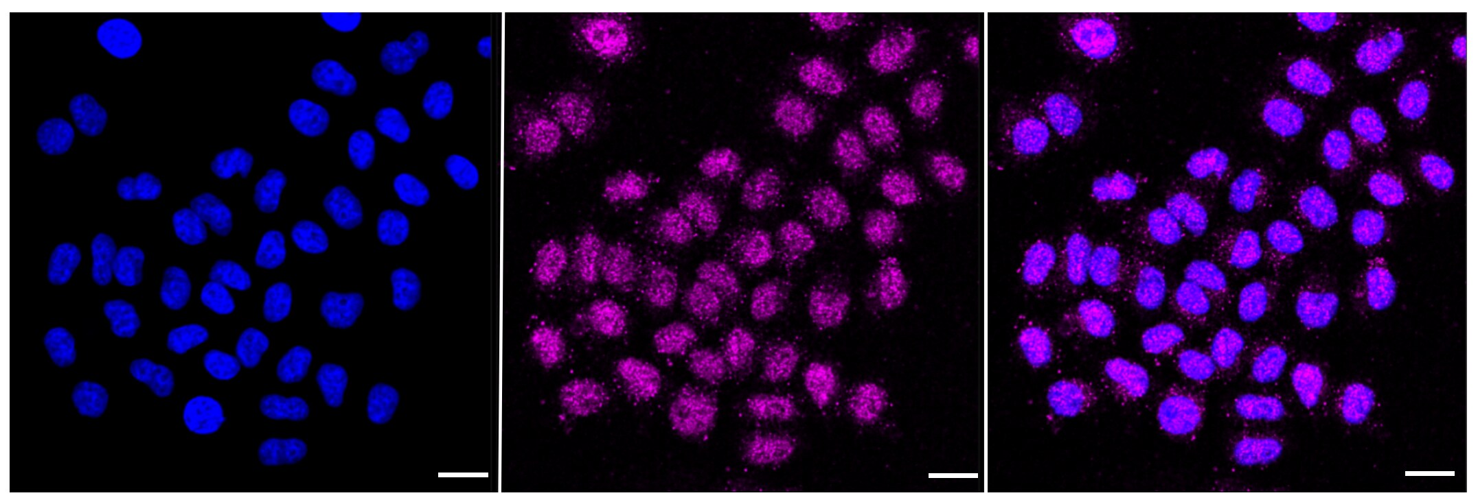 CYFIP1 Antibody (23GB1605)