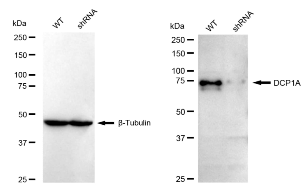 Dcp1a Antibody (23GB5150)