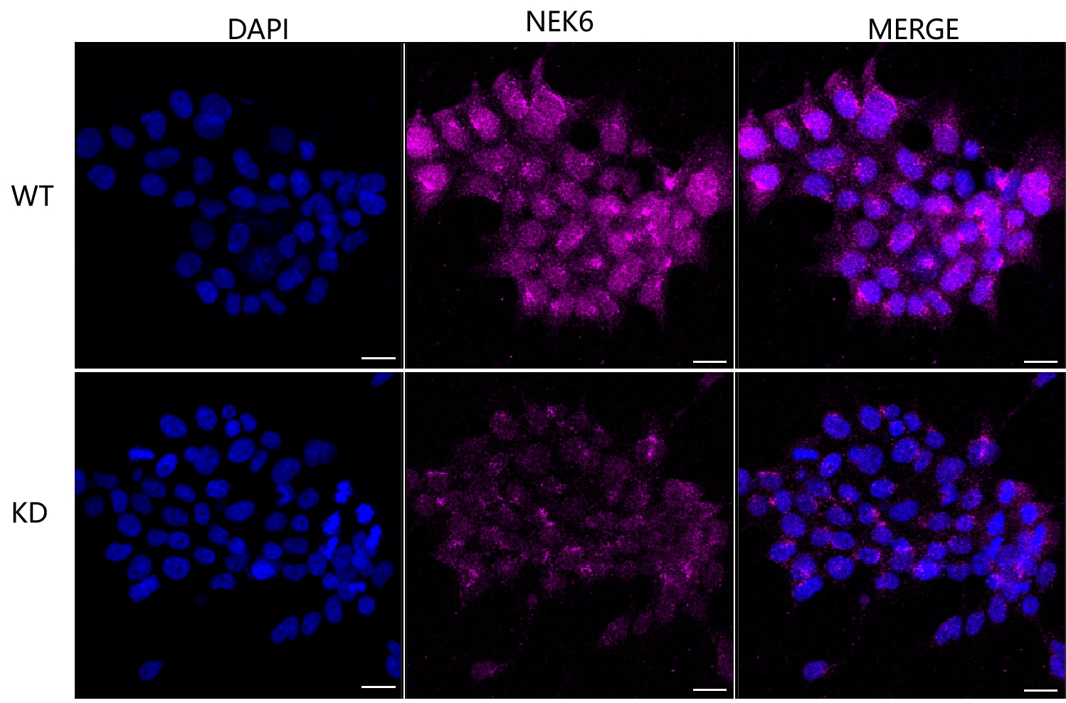 NEK6 Antibody (24GB755)