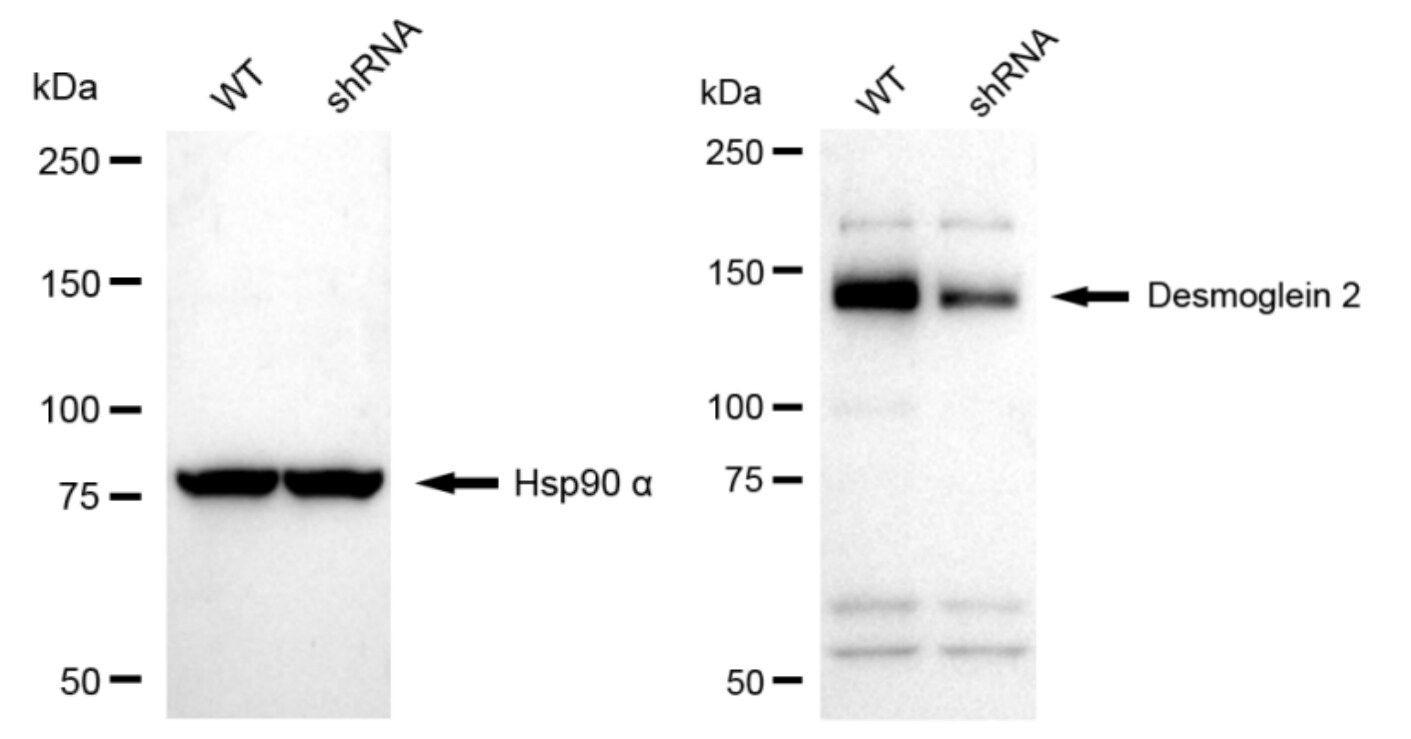 Desmoglein-2 Antibody (23GB5215)