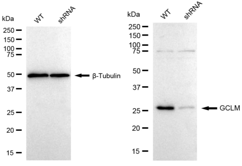GCLM Antibody (23GB5535)