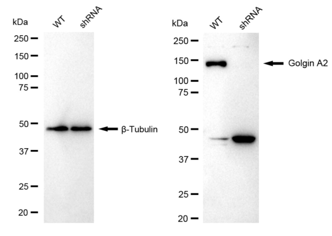 GM130/GOLGA2 Antibody (23GB5570)