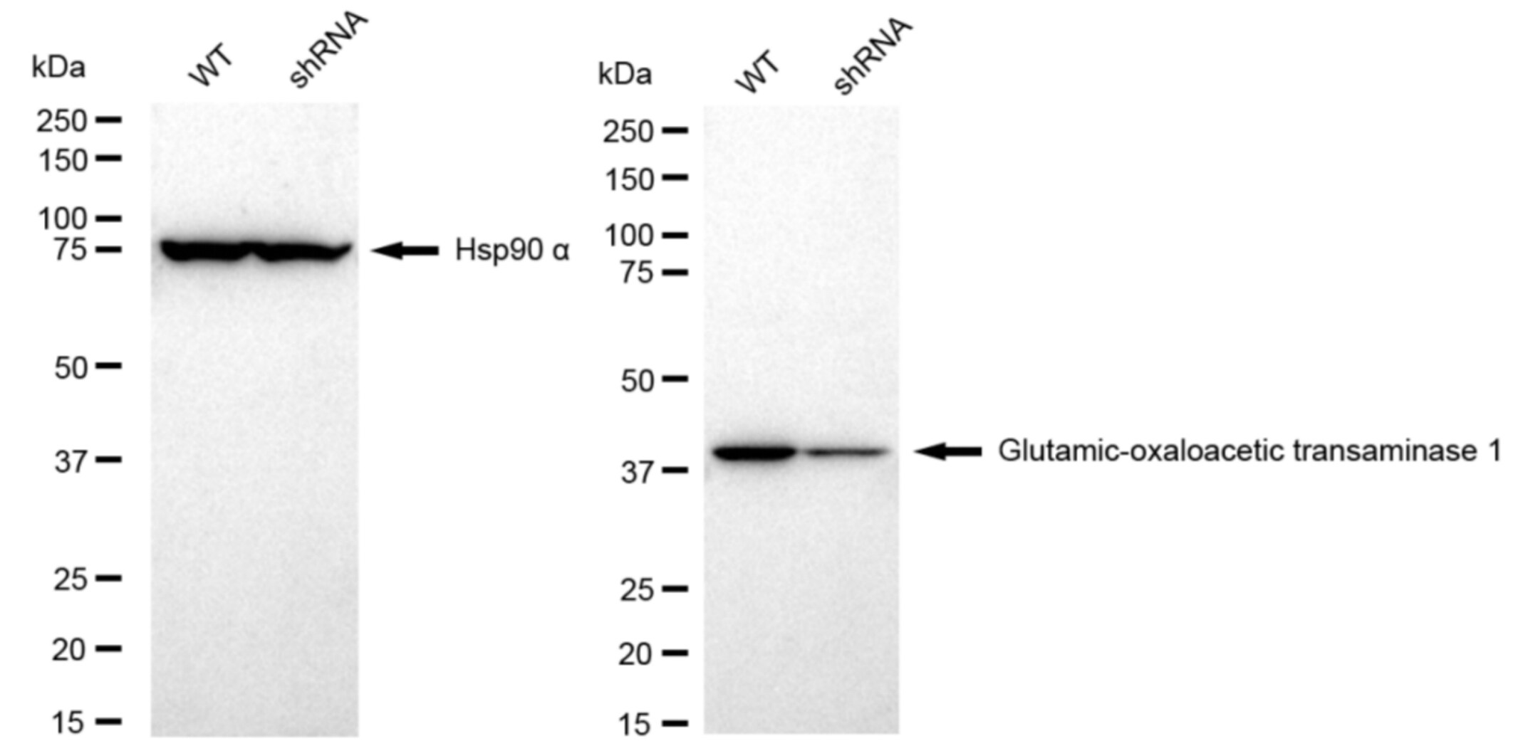 Aspartate Aminotransferase Antibody (23GB5585)