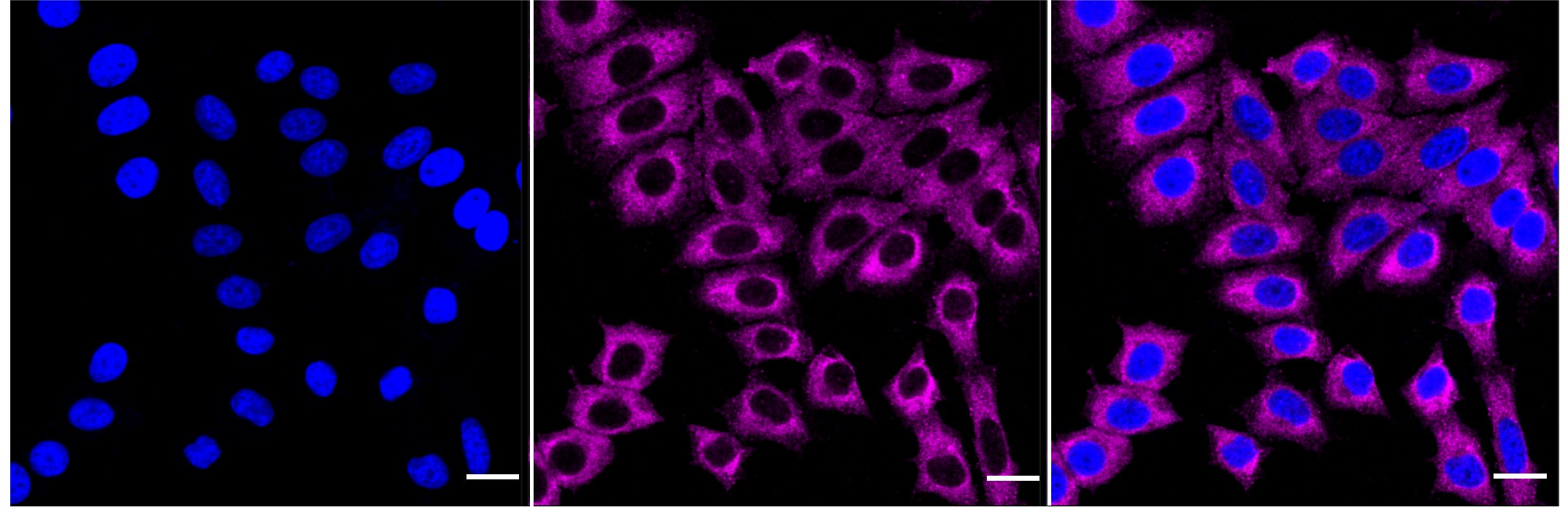 Acetyl-CoA Carboxylase alpha/ACACA Antibody (23GB5645)