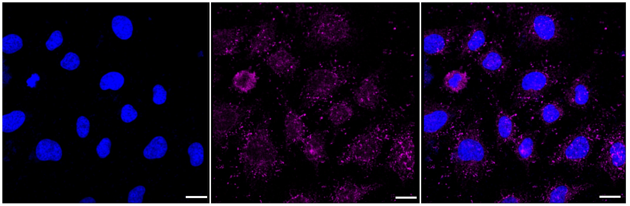 PIST Antibody (23GB5870)