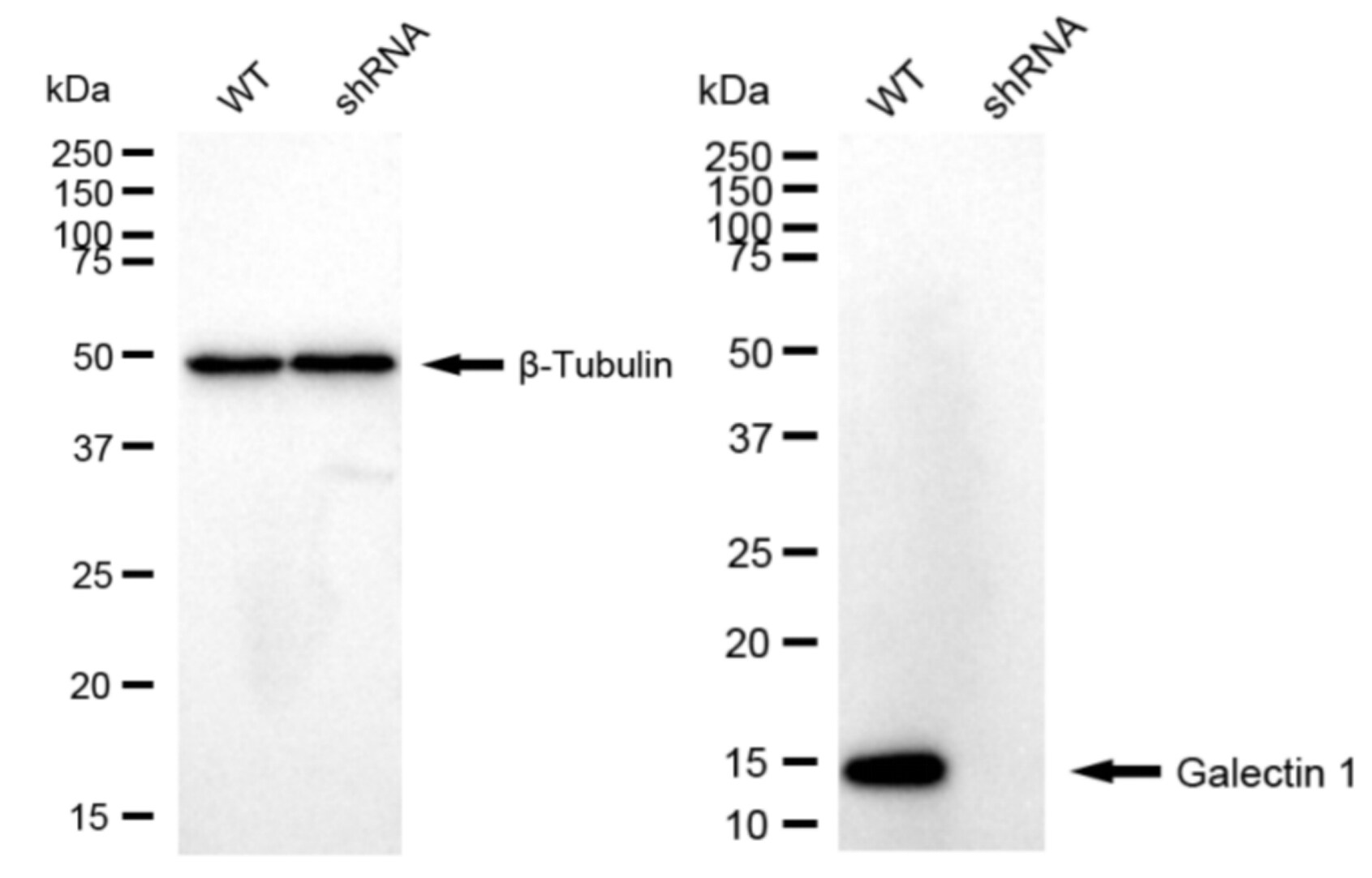 Galectin-1 Antibody (23GB6025)