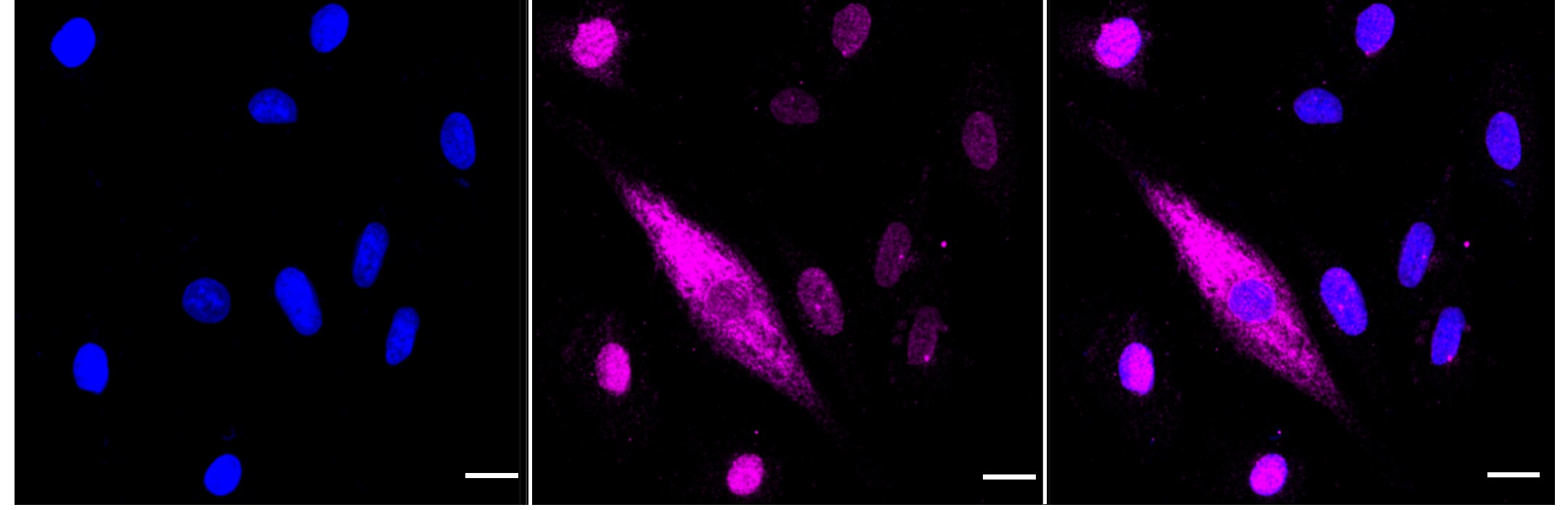 Cytokeratin 4 Antibody (23GB6150)