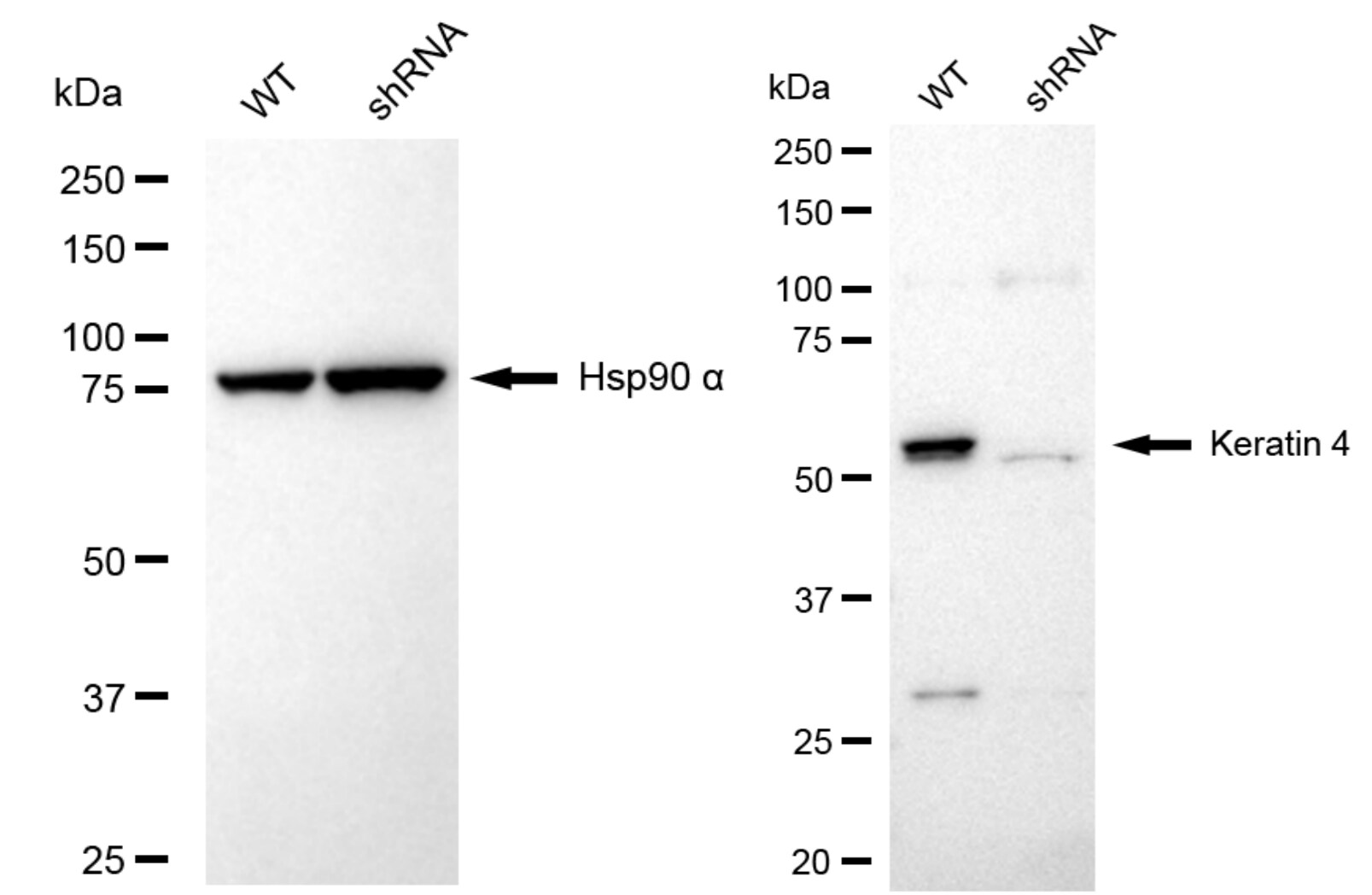 Cytokeratin 4 Antibody (23GB6150)