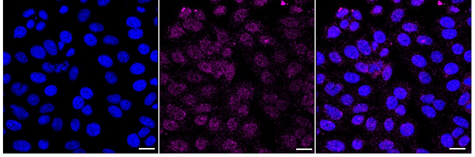 SR-BI Antibody (24GB1395)