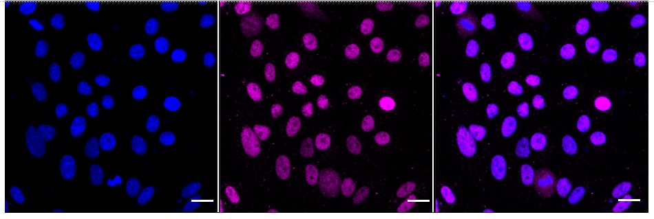AOF1 Antibody (23GB6265)