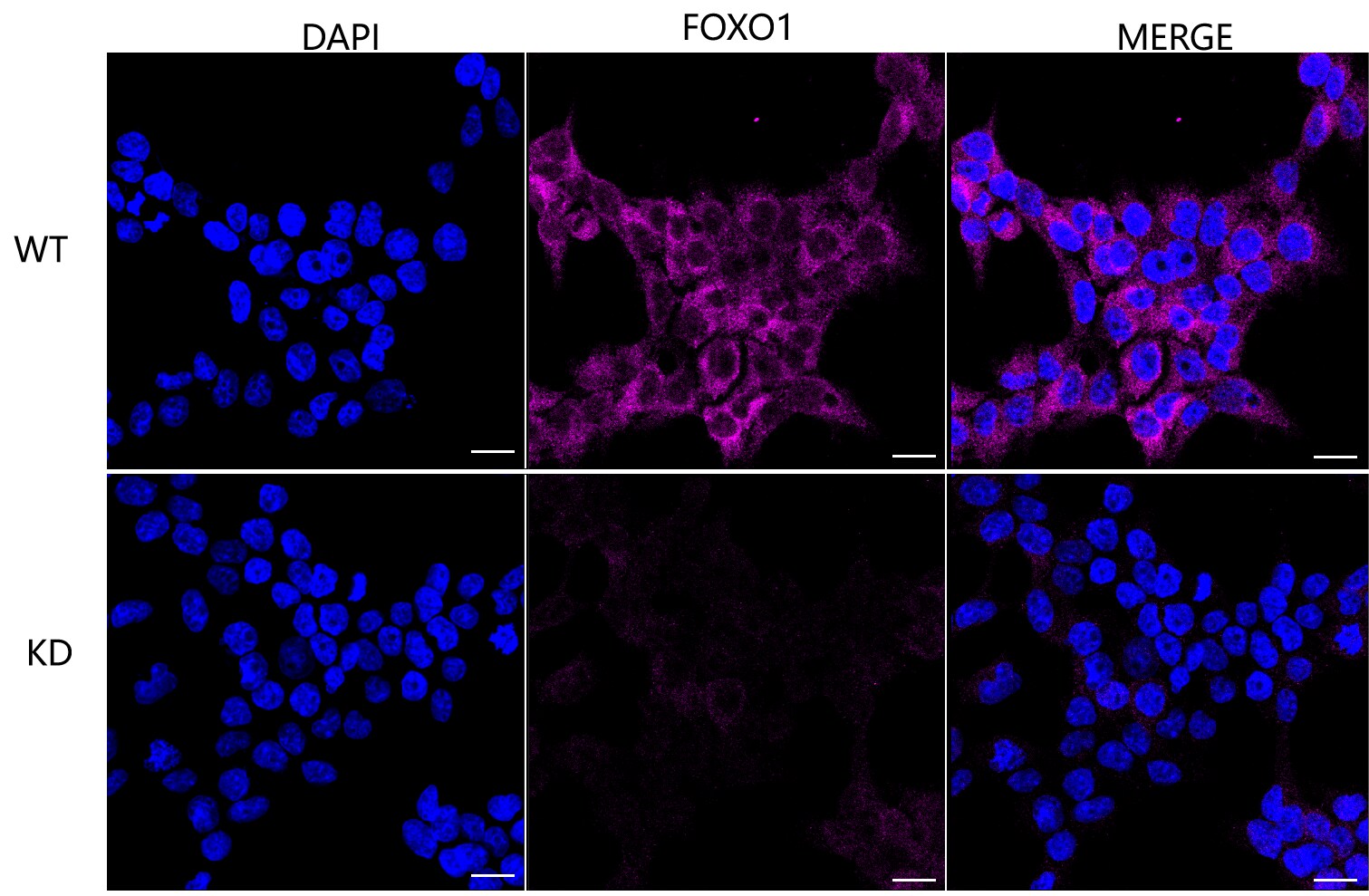 FoxO1/FKHR Antibody (23GB850)