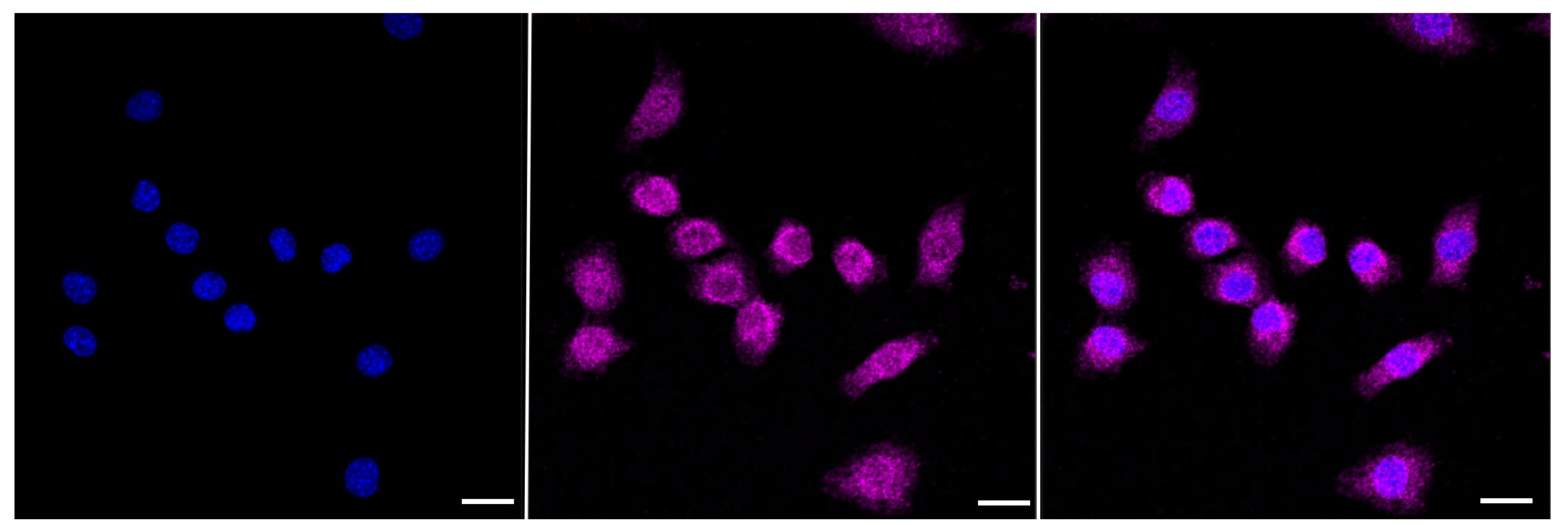 FoxO1/FKHR Antibody (23GB850)