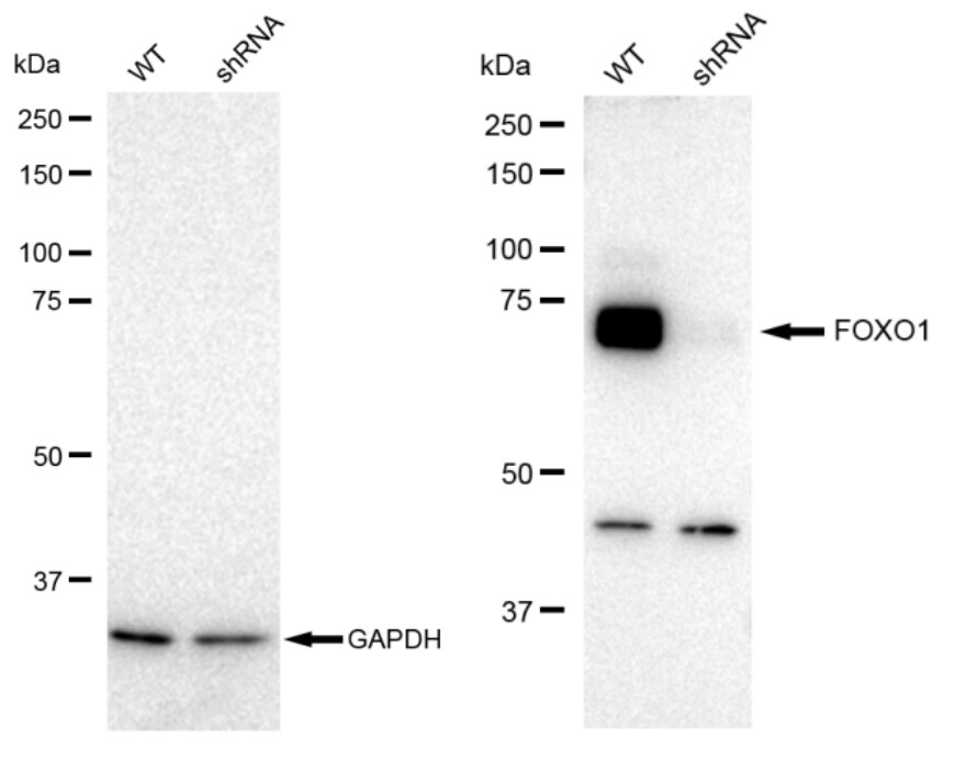 FoxO1/FKHR Antibody (23GB850)
