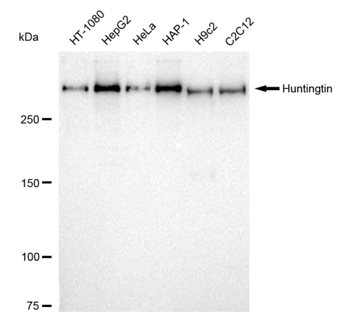 Huntingtin Antibody (23GB6285)