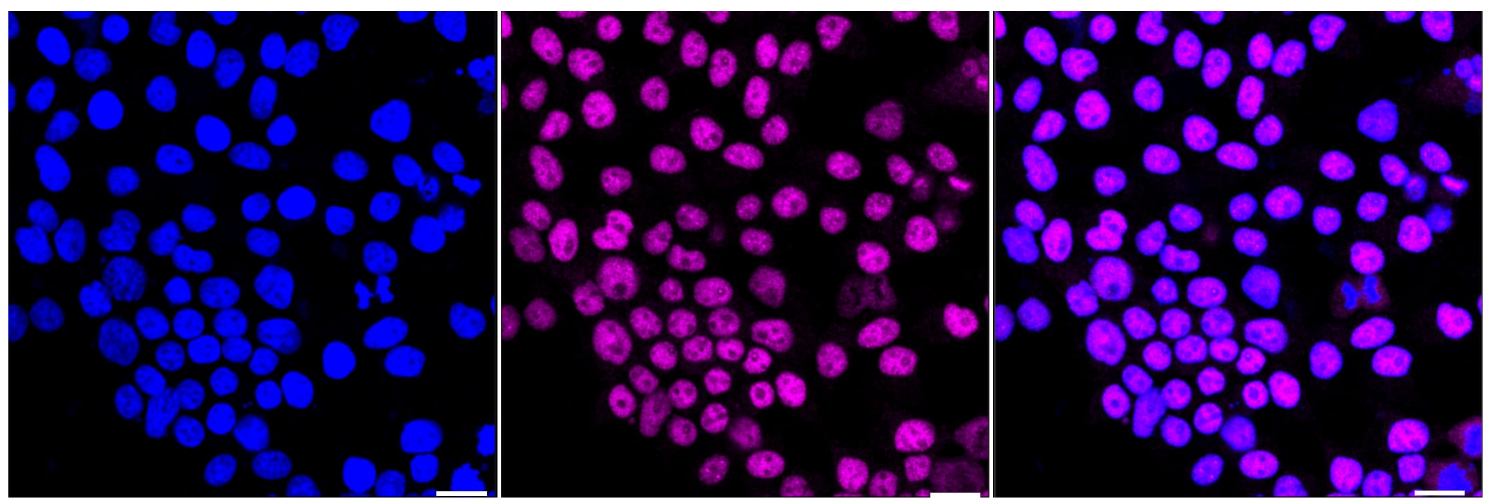 FIH-1/HIF-1AN Antibody (23GB6385)