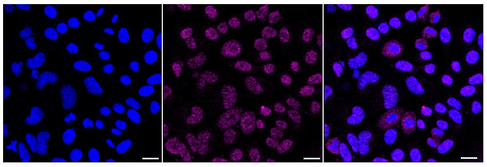 ISG15/UCRP Antibody (23GB6460)