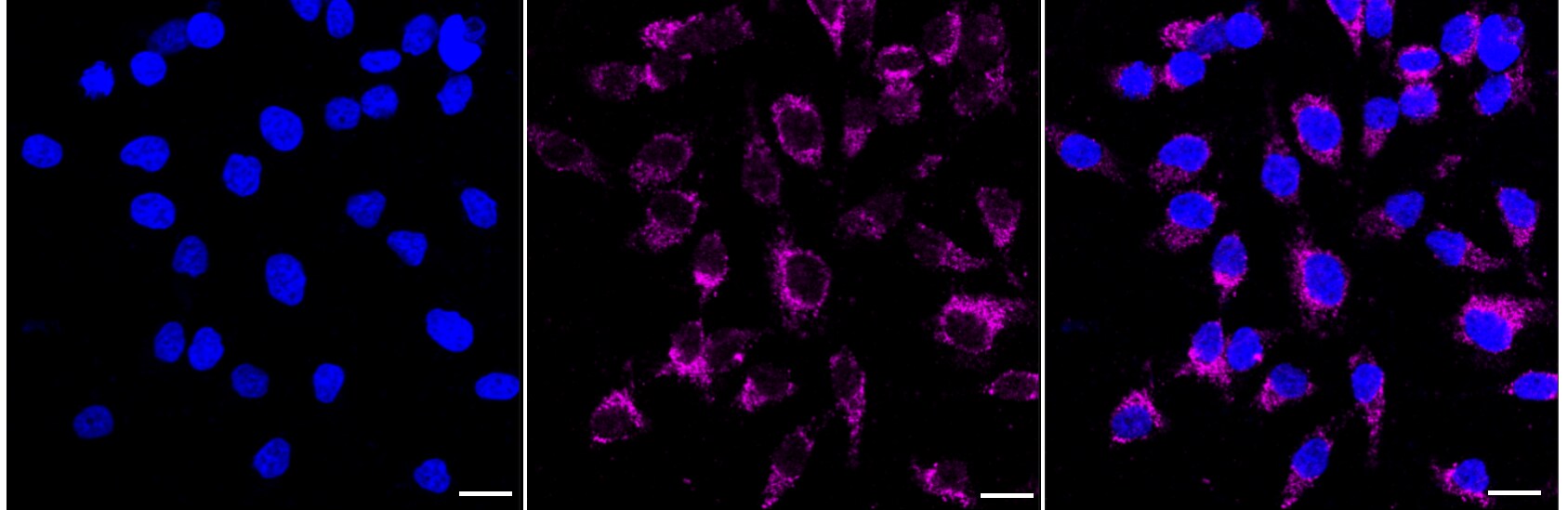 Cytokeratin 17 Antibody (23GB6535)