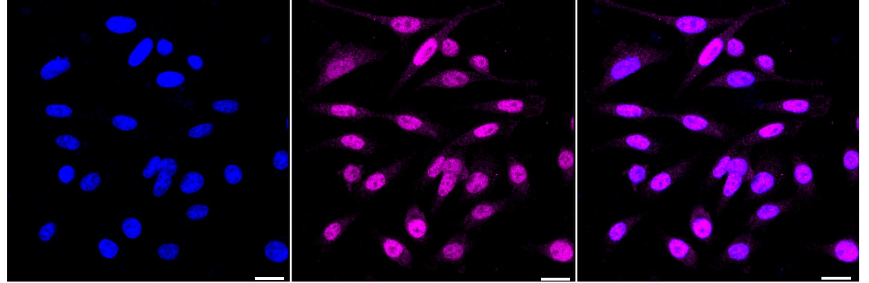 JunD Antibody (23GB6560)