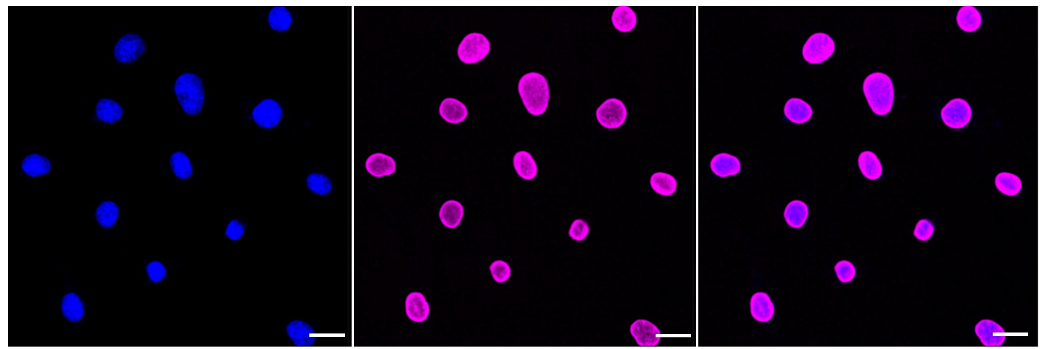 E2F-1 Antibody (23GB1505)