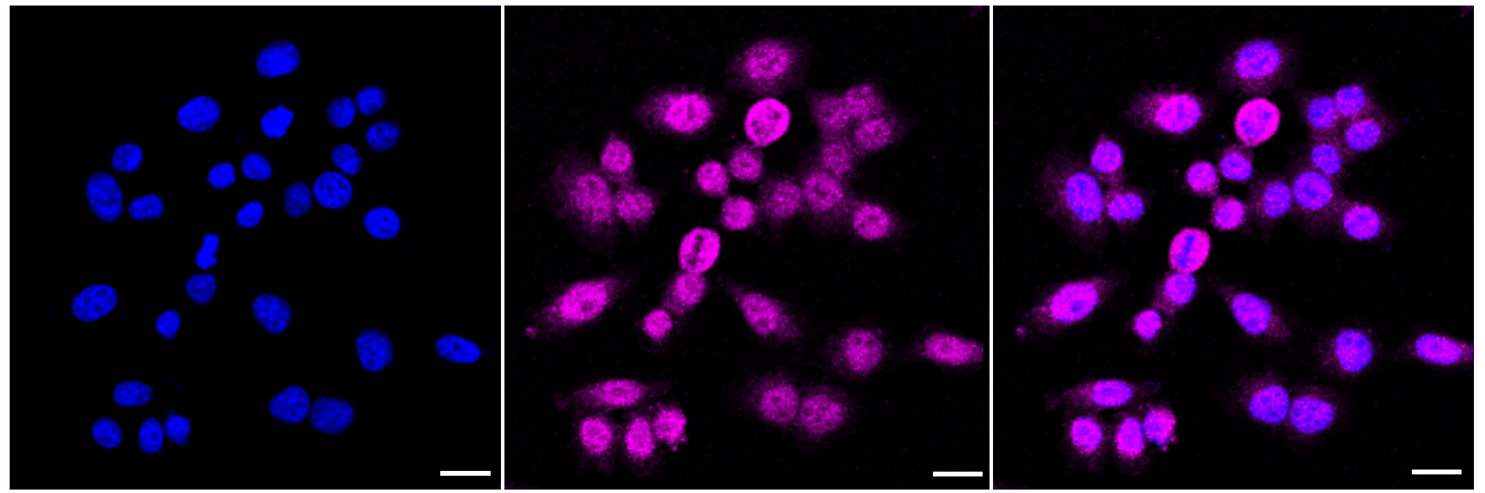 eEF-2 Antibody (23GB1550)