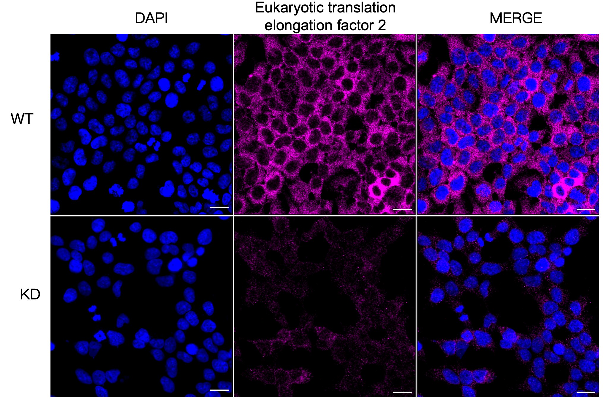 eEF-2 Antibody (23GB1550)