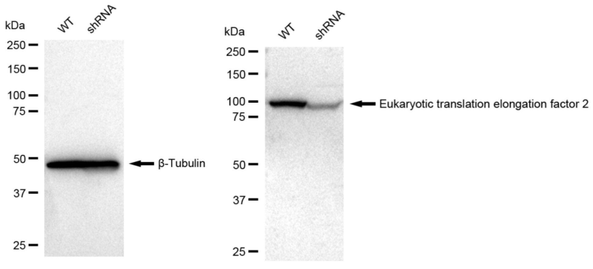 eEF-2 Antibody (23GB1550)