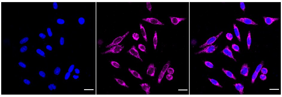 CECR5 Antibody (23GB6585)