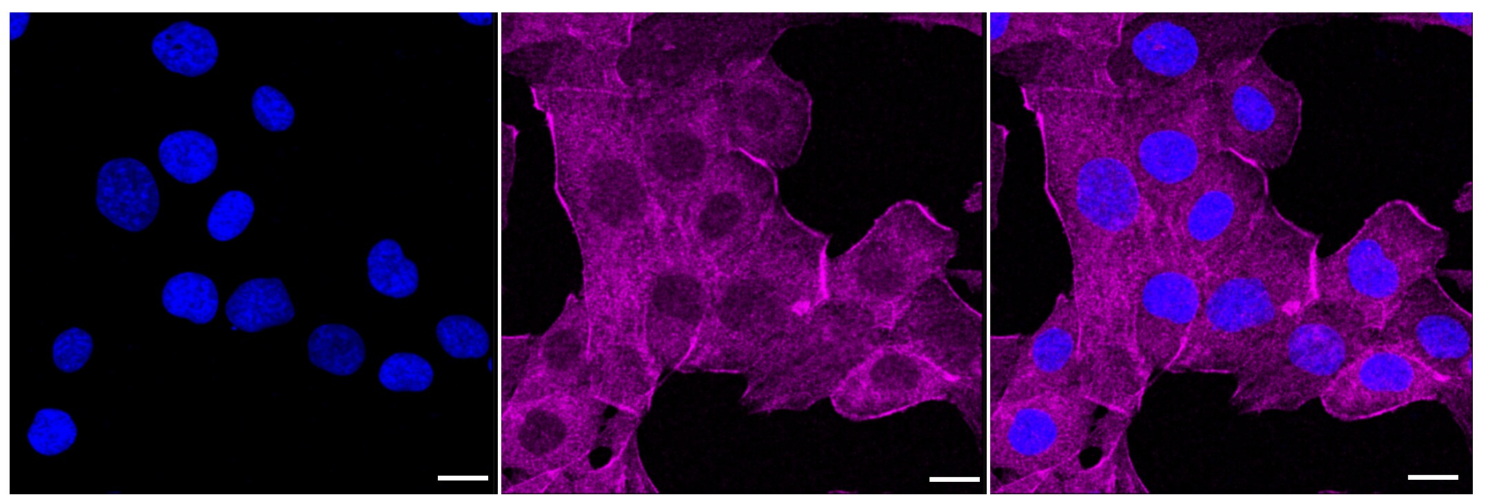 DEGS1 Antibody (23GB1215)