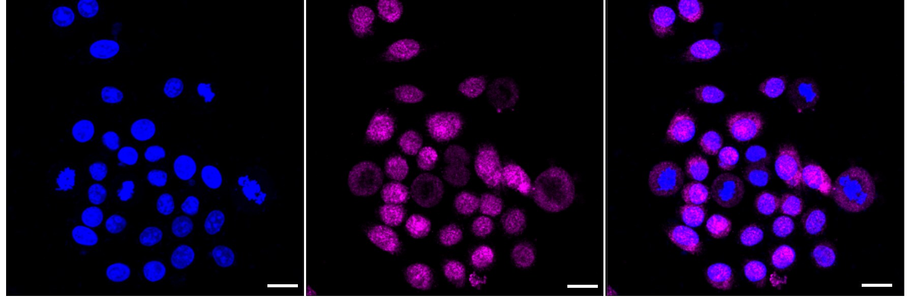 IL-13R alpha 1 Antibody (23GB6655)