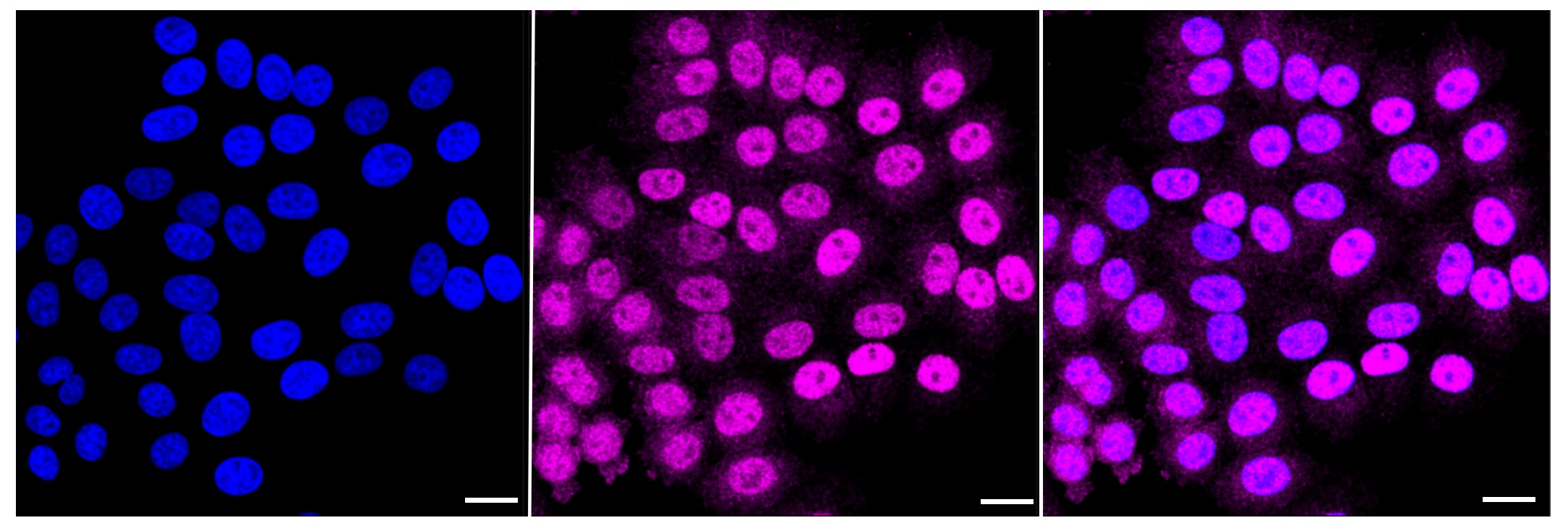PCTAIRE1 Antibody (23GB1495)