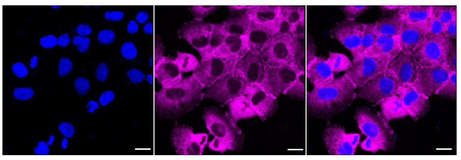 LPP Antibody (24GB05)
