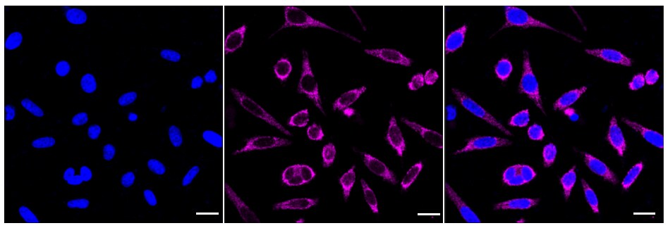 MRPS15 Antibody (24GB70)