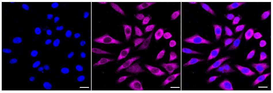 CNAP1 Antibody (24GB75)
