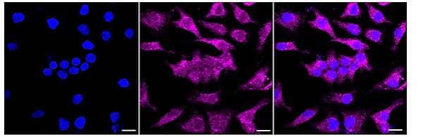 MADD Antibody (24GB110)