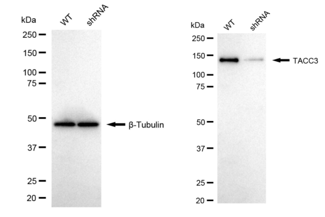 TACC3 Antibody (24GB1940)