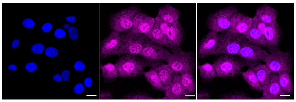 MVK Antibody (24GB115)