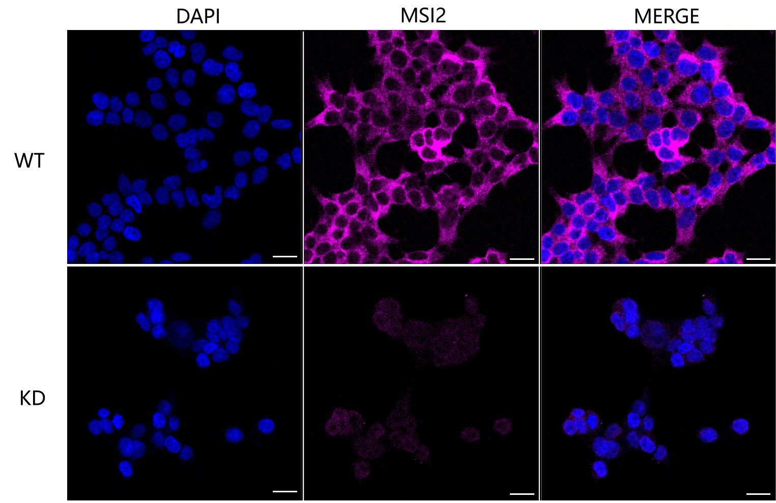 Musashi-2 Antibody (24GB225)