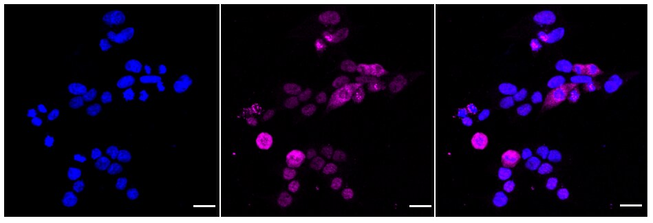 MyD88 Antibody (24GB240)
