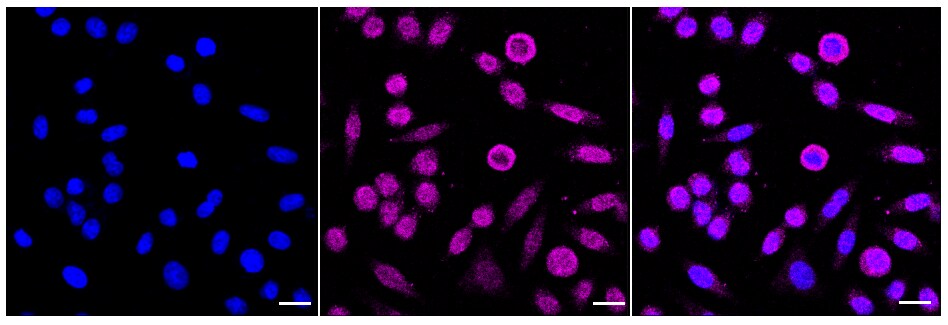 NQO-2 Antibody (24GB250)