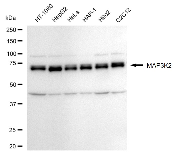 MEKK2 Antibody (24GB260)