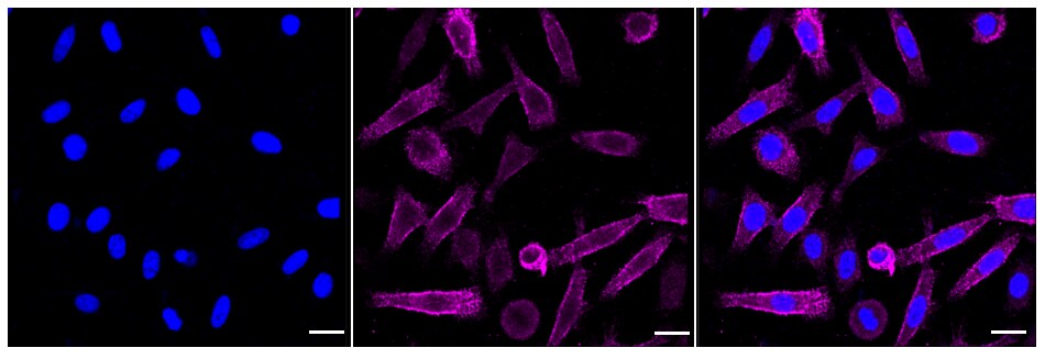 Moesin Antibody (24GB265)