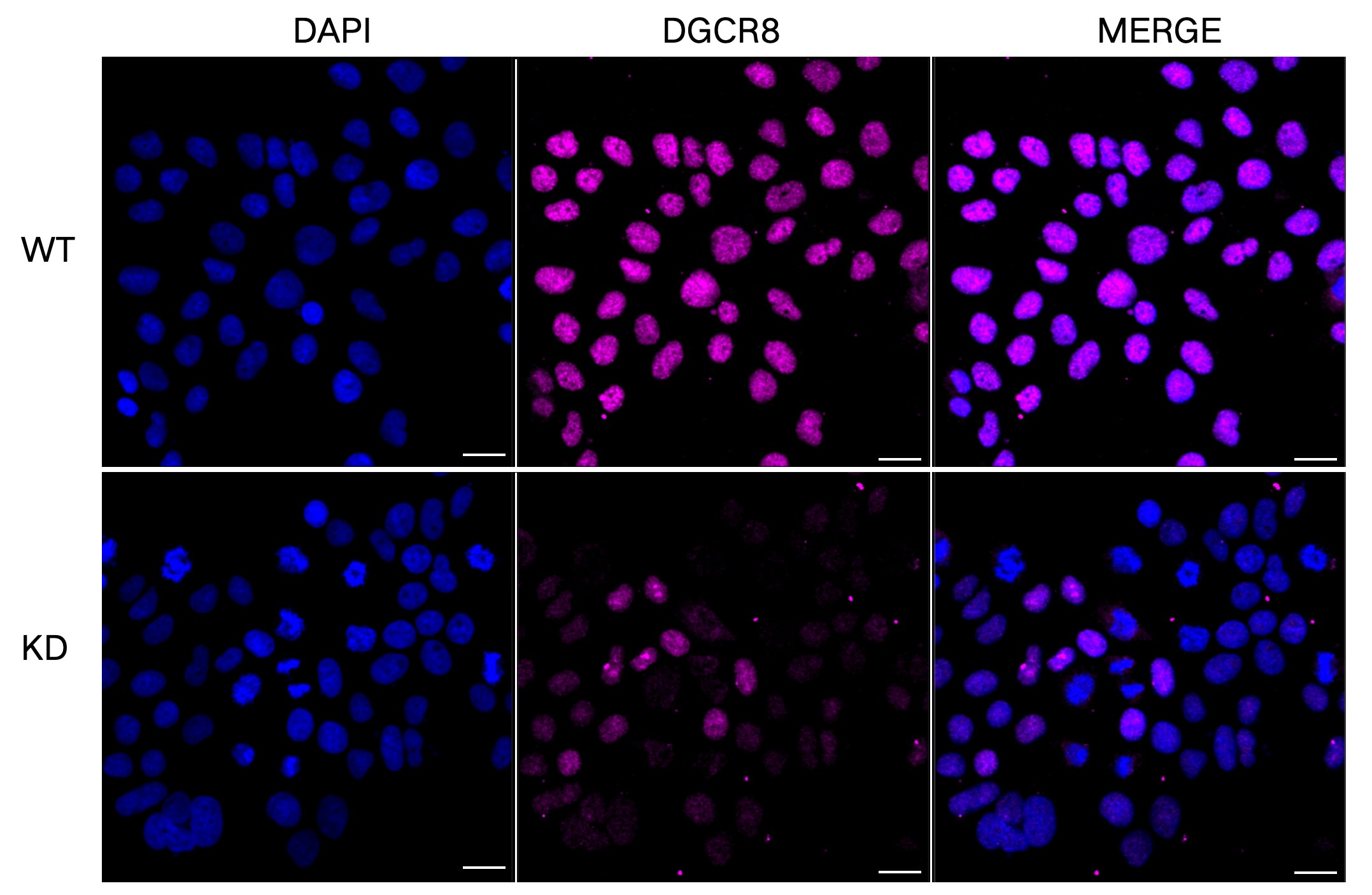 DGCR8 Antibody (23GB1615)