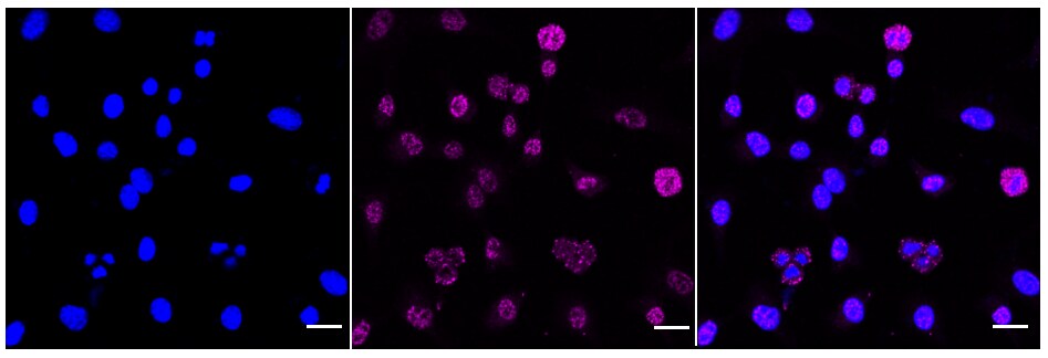 MEK1 [p Thr292] Antibody (24GB305)