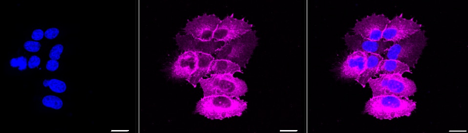 EGFR Antibody (23GB810)